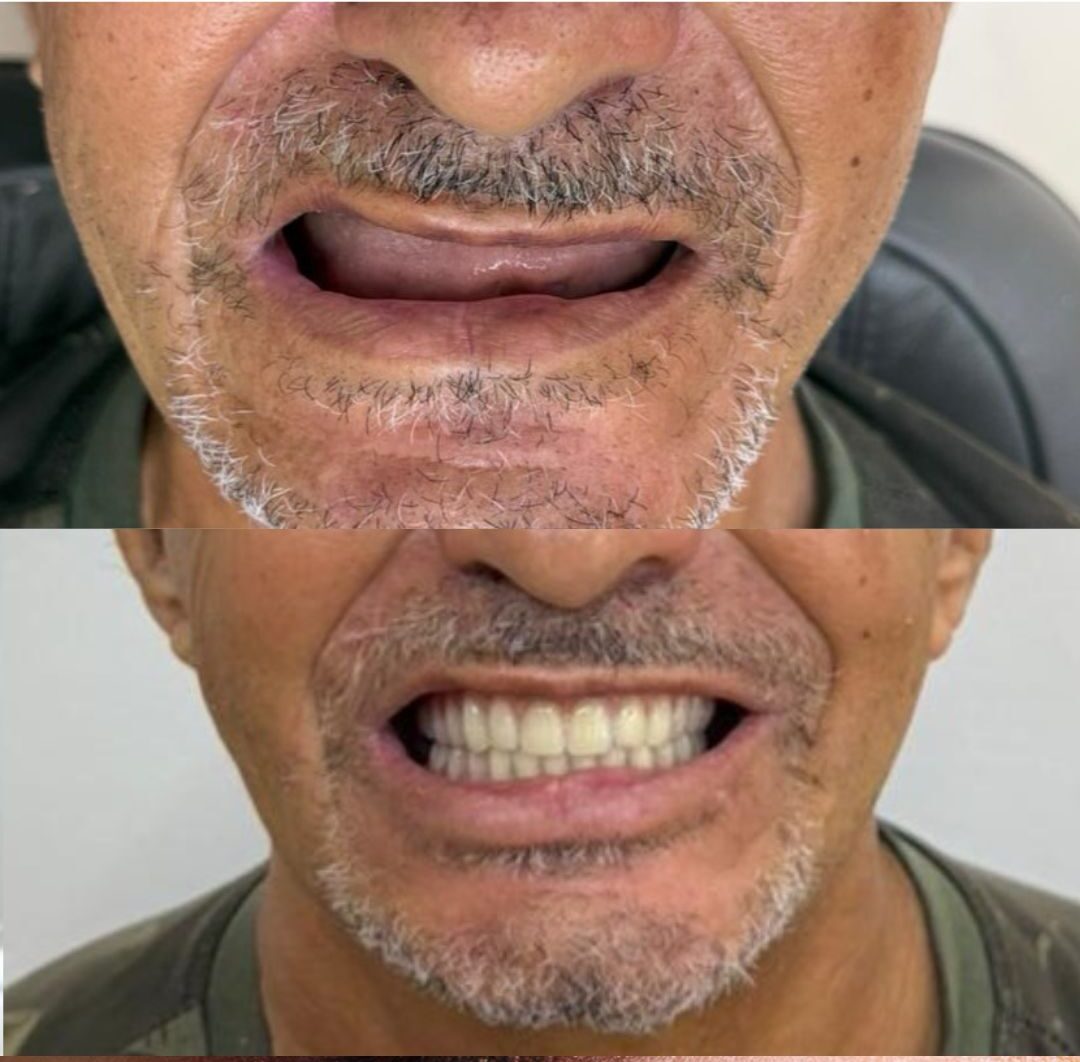 Beige Minimalist Beauty Before After Collage Instagram Post (2)