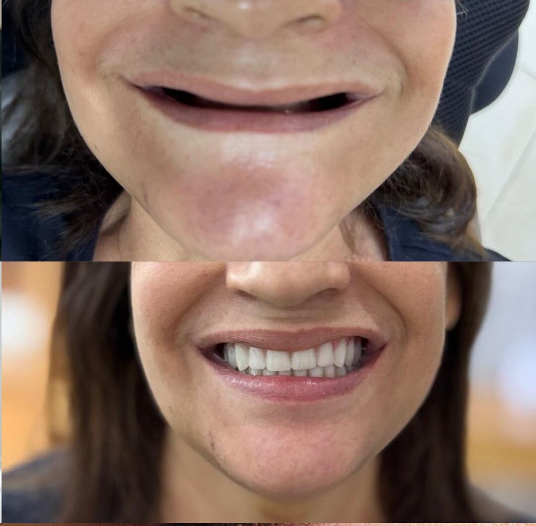 Beige Minimalist Beauty Before After Collage Instagram Post (3)
