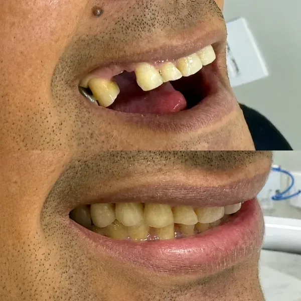 imgi_4_antes-depois-2